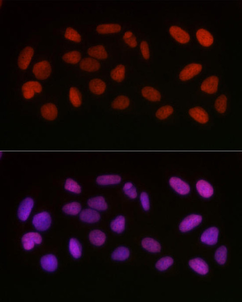 KO Validated Antibodies 1 Anti-Acetyl-HMGB1-K29 Antibody CAB16002KO Validated