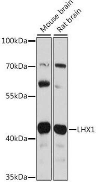 Developmental Biology Anti-LHX1 Antibody CAB16055