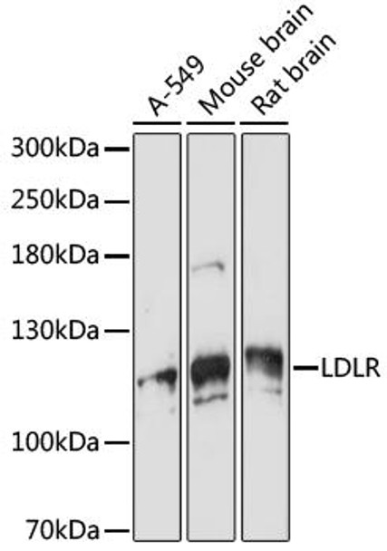 Cell Biology Antibodies 14 Anti-VPS18 Antibody CAB16654