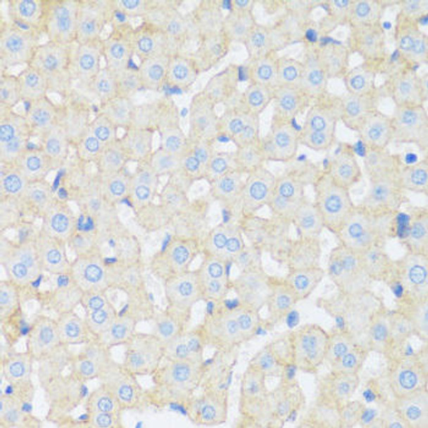 Cell Biology Antibodies 14 Anti-ASGR1 Antibody CAB16766
