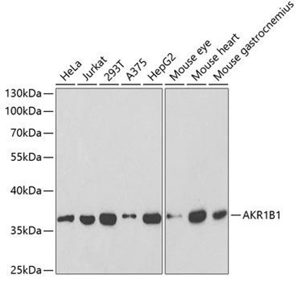 Cell Biology Antibodies 14 Anti-AKR1B1 Antibody CAB1684