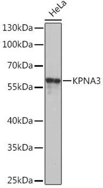 Immunology Antibodies 3 Anti-KPNA3 Antibody CAB16907