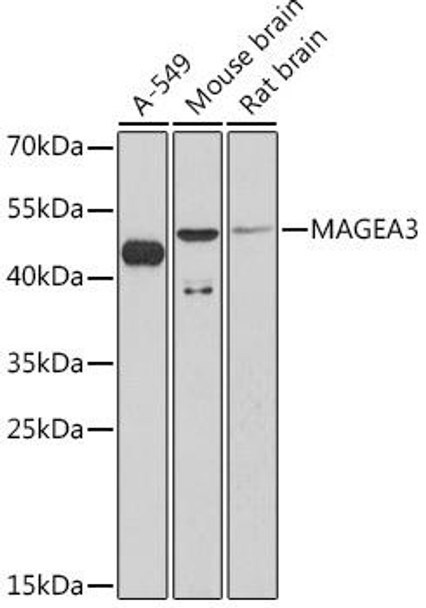 Cell Biology Antibodies 14 Anti-MAGEA3 Antibody CAB16915