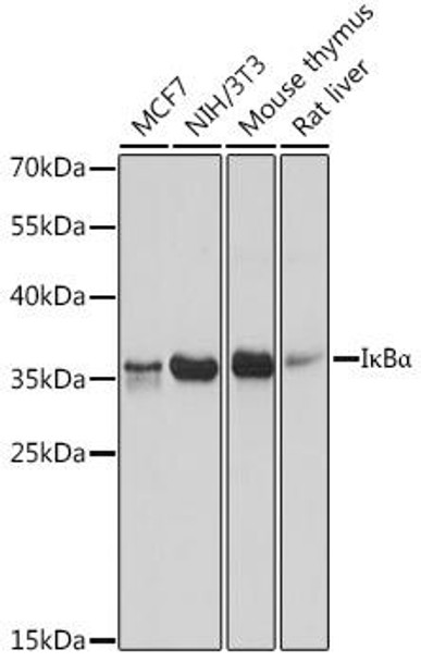 Immunology Antibodies 3 Anti-IkBAlpha Antibody CAB16929