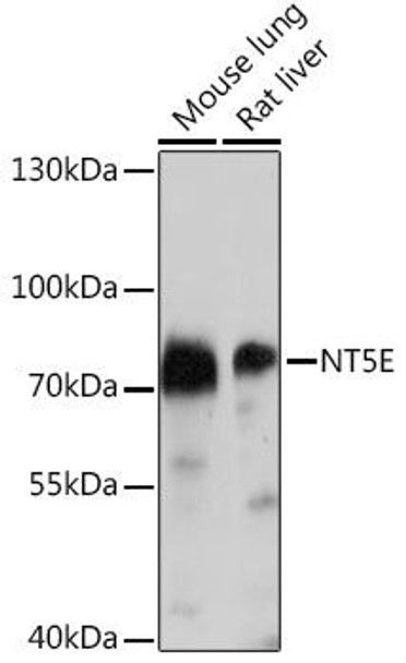 Cell Biology Antibodies 14 Anti-NT5E Antibody CAB16936