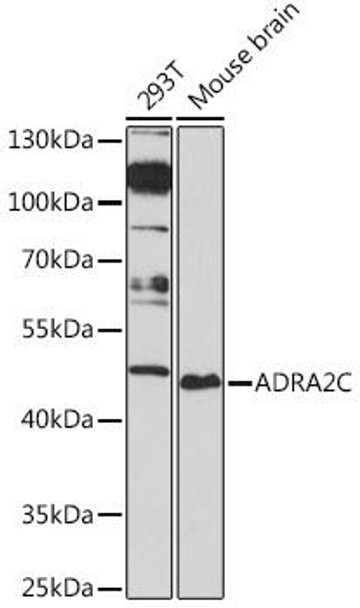 Cell Biology Antibodies 14 Anti-ADRA2C Antibody CAB16956