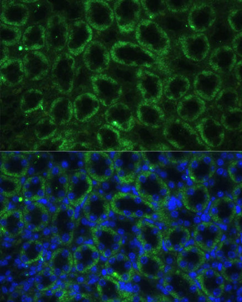 Cell Biology Antibodies 14 Anti-TBCE Antibody CAB16978