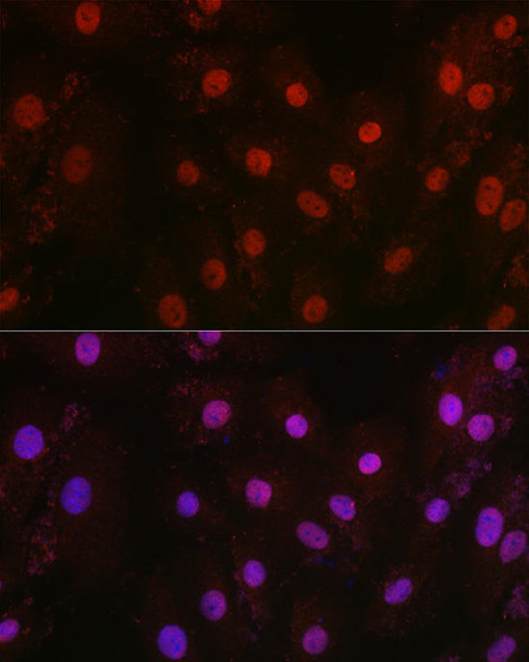 Epigenetics and Nuclear Signaling Antibodies 5 Anti-HIF1Beta/ARNT Antibody CAB16990