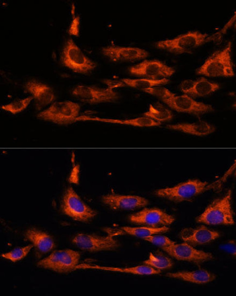 Cell Biology Antibodies 14 Anti-ACOX3 Antibody CAB17020