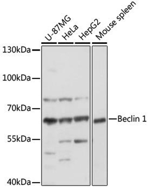 Immunology Antibodies 3 Anti-BECN1 Antibody CAB17028
