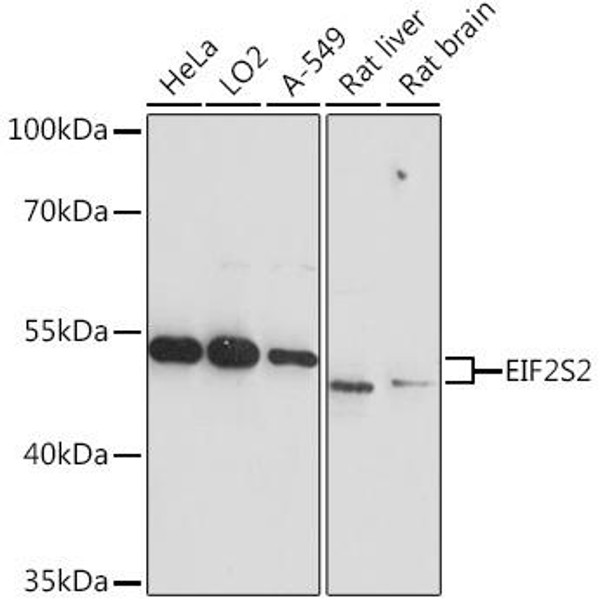 Metabolism Antibodies 3 Anti-EIF2S2 Antibody CAB17040