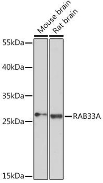 Cell Biology Antibodies 14 Anti-RAB33A Antibody CAB17049