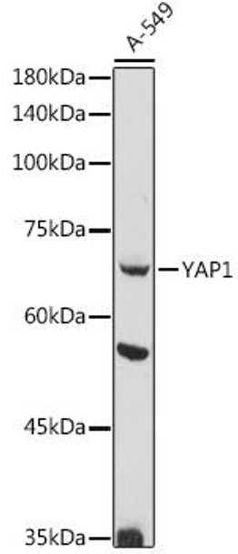 Epigenetics and Nuclear Signaling Antibodies 5 Anti-YAP1 Antibody CAB17075