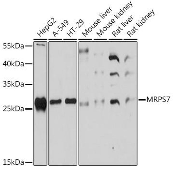 Cell Biology Antibodies 13 Anti-MRPS7 Antibody CAB17150