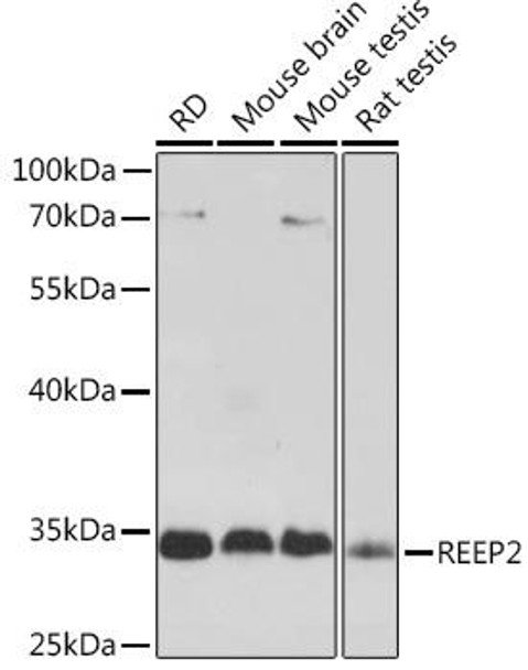 Cell Biology Antibodies 13 Anti-REEP2 Antibody CAB17152