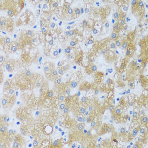 Cell Biology Antibodies 13 Anti-ASB4 Antibody CAB17159