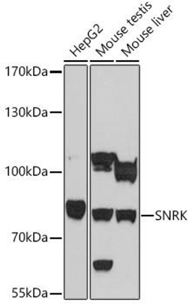 Cell Biology Antibodies 13 Anti-SNRK Antibody CAB17171