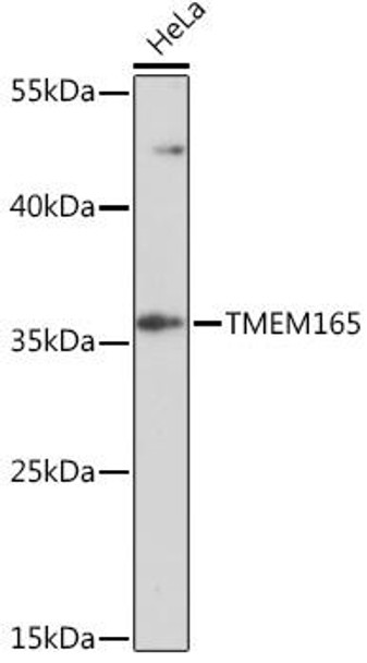 Cell Biology Antibodies 13 Anti-TMEM165 Antibody CAB17183