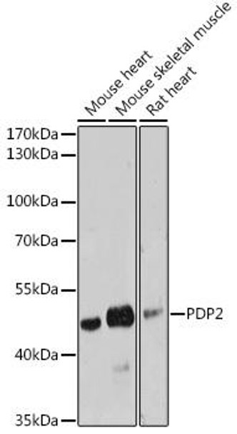 Metabolism Antibodies 3 Anti-PDP2 Antibody CAB17190