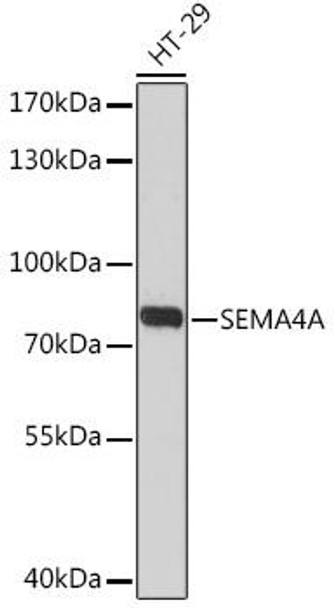 Cell Biology Antibodies 13 Anti-SEMA4A Antibody CAB17205