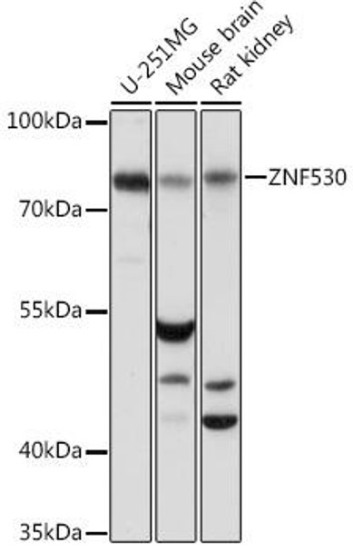 Cell Biology Antibodies 13 Anti-ZNF530 Antibody CAB17278