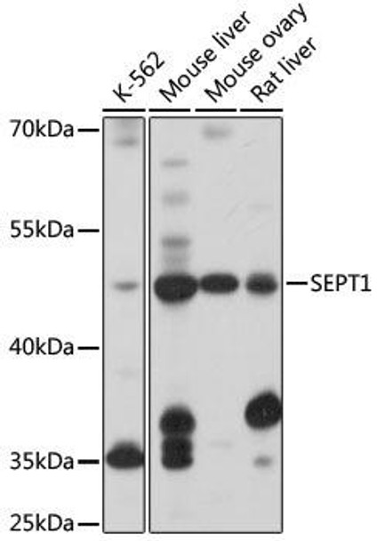 Cell Biology Antibodies 13 Anti-SEPT1 Antibody CAB17471