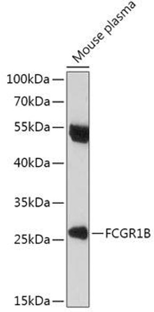 Cell Biology Antibodies 13 Anti-FCGR1B Antibody CAB17483