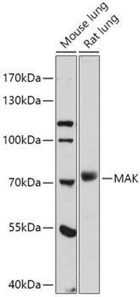 Cell Biology Antibodies 13 Anti-MAK Antibody CAB17508