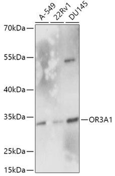 Cell Biology Antibodies 13 Anti-OR3A1 Antibody CAB17512
