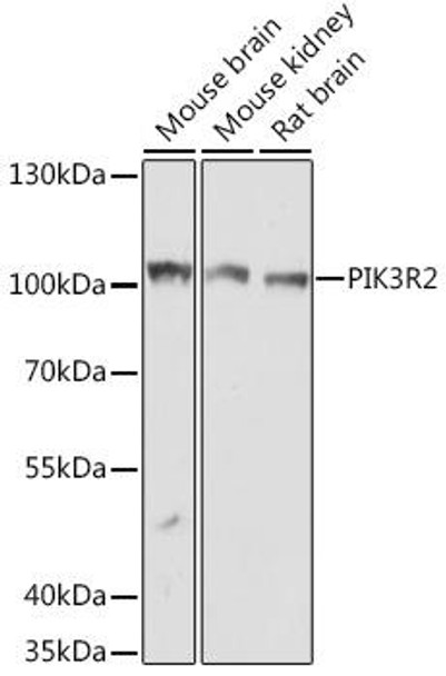 Cell Biology Antibodies 13 Anti-PIK3R2 Antibody CAB17518