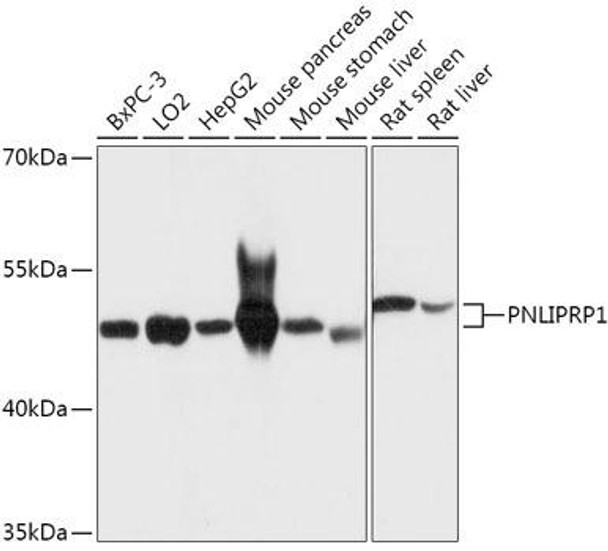 Cell Biology Antibodies 13 Anti-PNLIPRP1 Antibody CAB17520
