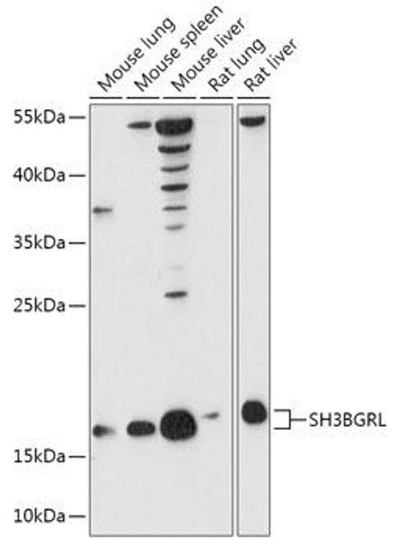 Cell Biology Antibodies 13 Anti-SH3BGRL Antibody CAB17530