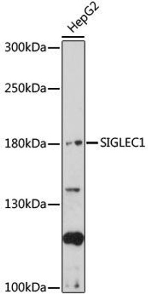 Cell Biology Antibodies 13 Anti-SIGLEC1 Antibody CAB17533