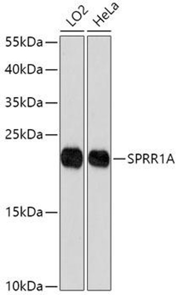 Cell Biology Antibodies 13 Anti-SPRR1A Antibody CAB17535