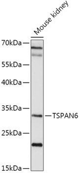 Cell Biology Antibodies 13 Anti-TSPAN6 Antibody CAB17540
