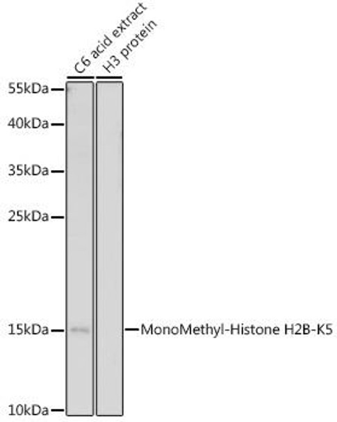 Cell Biology Antibodies 13 Anti-MonoMethyl-Histone H2B-K5 Antibody CAB17552