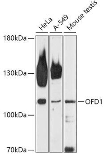 Cell Biology Antibodies 13 Anti-OFD1 Antibody CAB17567