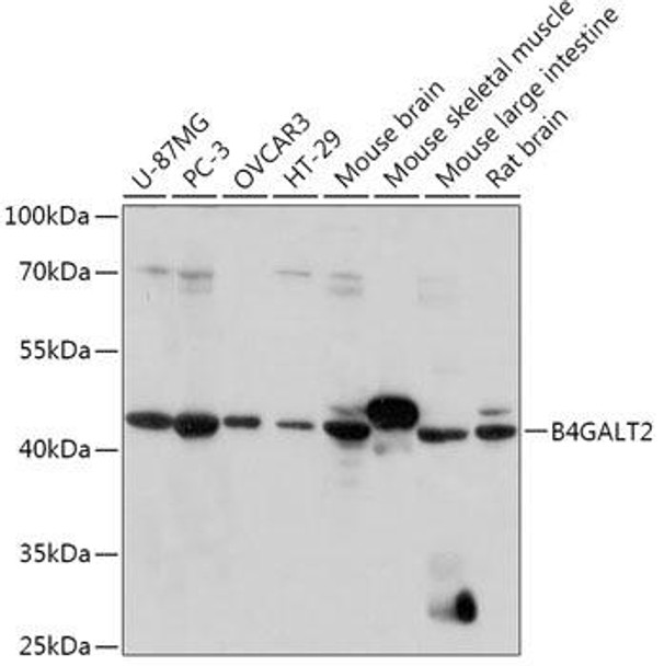 Cell Biology Antibodies 13 Anti-B4GALT2 Antibody CAB17573