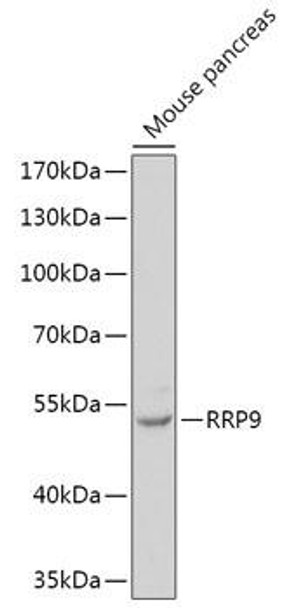 Cell Biology Antibodies 13 Anti-RRP9 Antibody CAB17588
