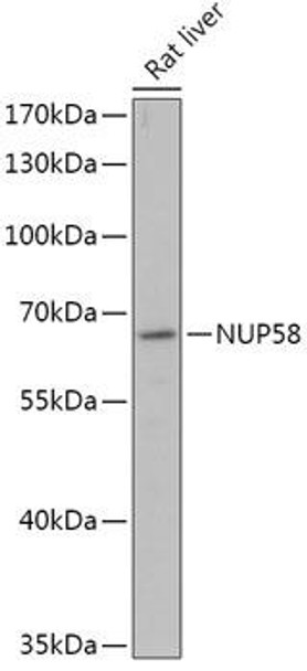 Cell Biology Antibodies 13 Anti-NUP58 Antibody CAB17598