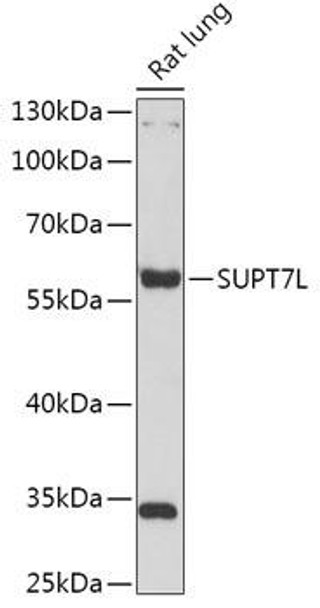 Cell Biology Antibodies 13 Anti-SUPT7L Antibody CAB17601