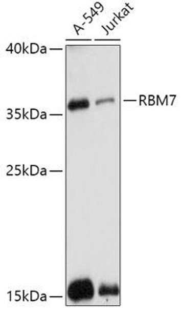 Cell Biology Antibodies 13 Anti-RBM7 Antibody CAB17605
