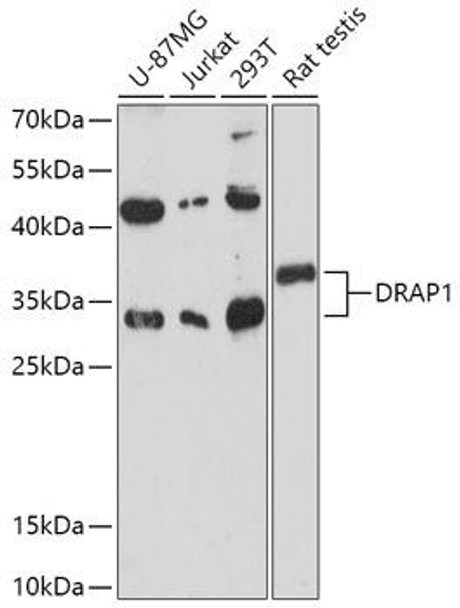 Cell Biology Antibodies 13 Anti-DRAP1 Antibody CAB17616