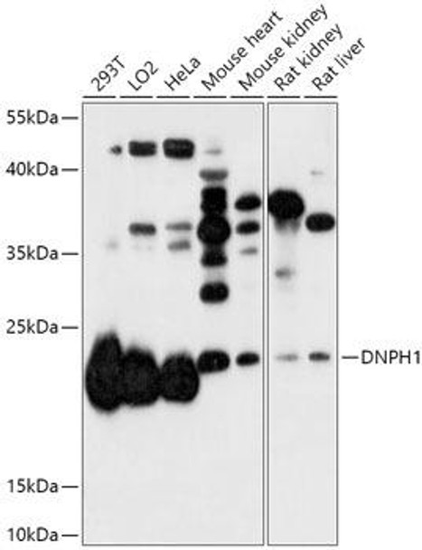 Cell Biology Antibodies 13 Anti-DNPH1 Antibody CAB17617