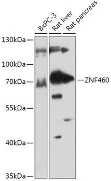 Cell Biology Antibodies 13 Anti-ZNF460 Antibody CAB17621