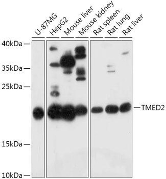 Cell Biology Antibodies 13 Anti-TMED2 Antibody CAB17622