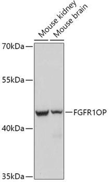 Cell Biology Antibodies 13 Anti-FGFR1OP Antibody CAB17627