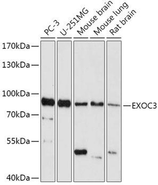 Cell Biology Antibodies 13 Anti-EXOC3 Antibody CAB17635