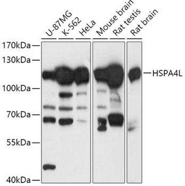 Cell Biology Antibodies 13 Anti-HSPA4L Antibody CAB17637
