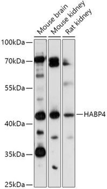 Cell Biology Antibodies 13 Anti-HABP4 Antibody CAB17644